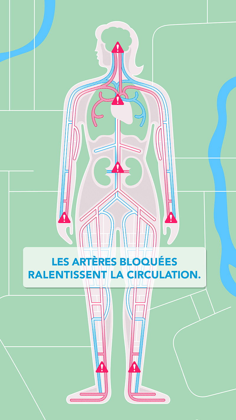 Votre santé vasculaire